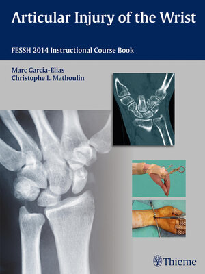 cover image of Articular Injury of the Wrist